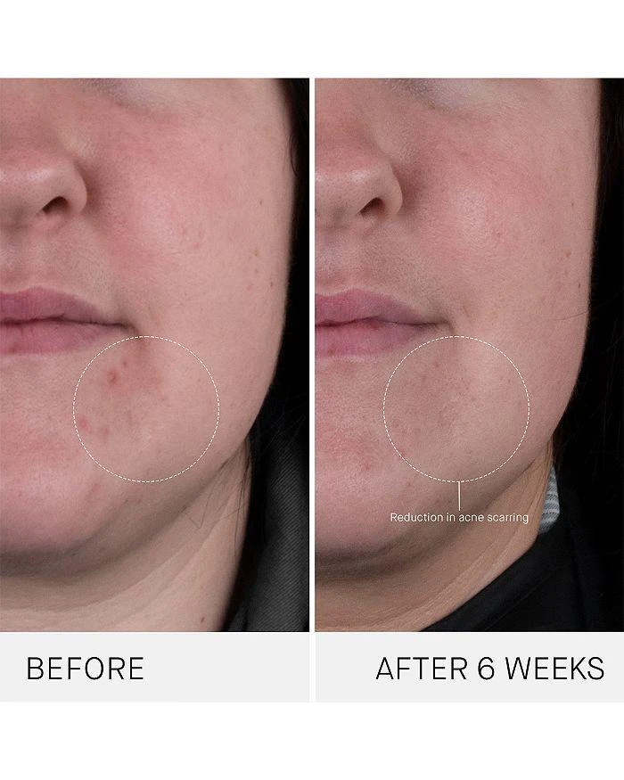 Augustinus Bader The Rich Cream 7