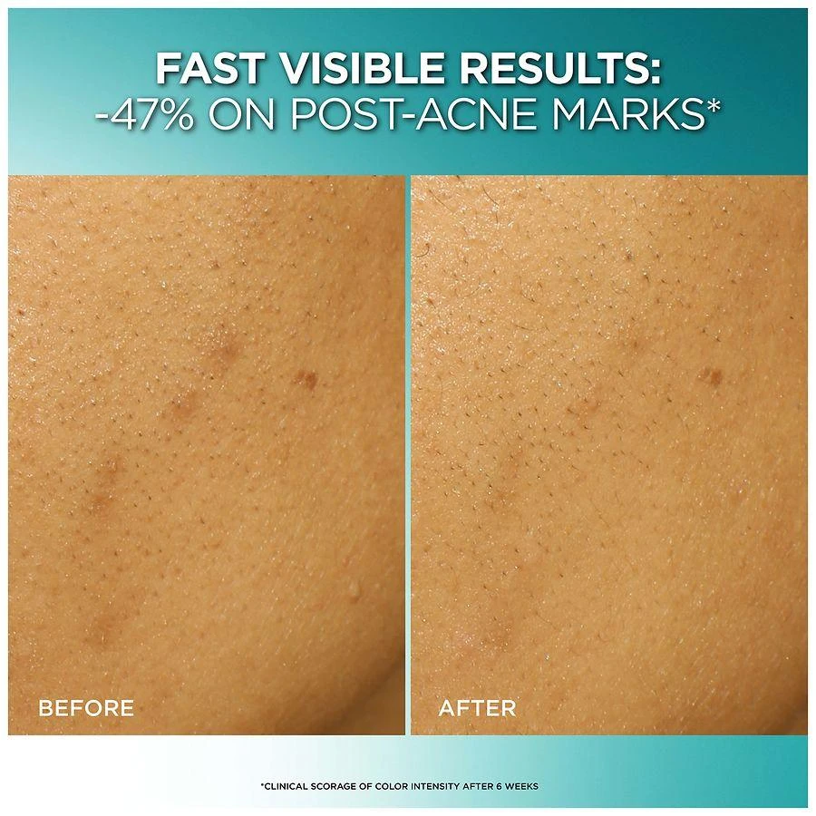 L'Oreal Paris Bright Reveal Dark Spot Exfoliant Peel with 25% AHA BHA PHA Blend 9