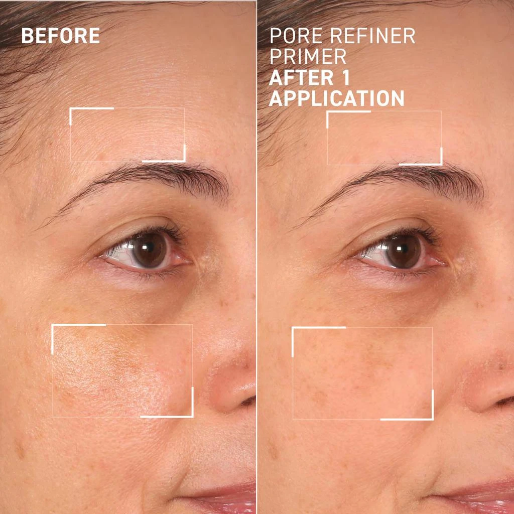 Dr. Brandt Skincare Best in Brandt 6