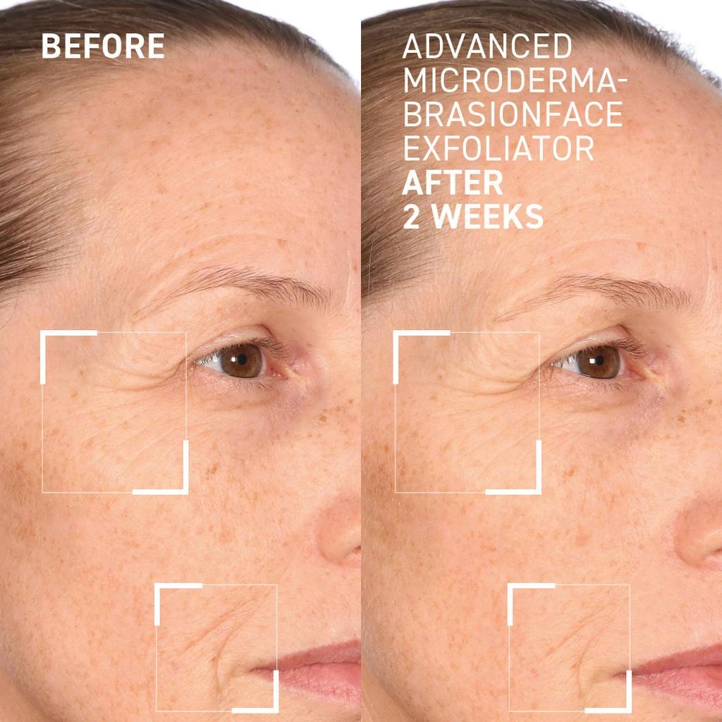 Dr. Brandt Skincare Advanced Face Exfoliator 4