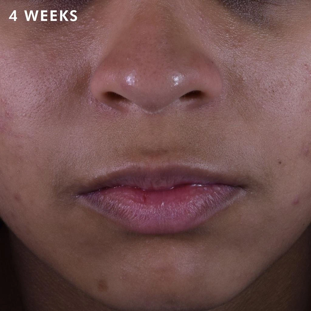 SkinCeuticals Silymarin CF 4