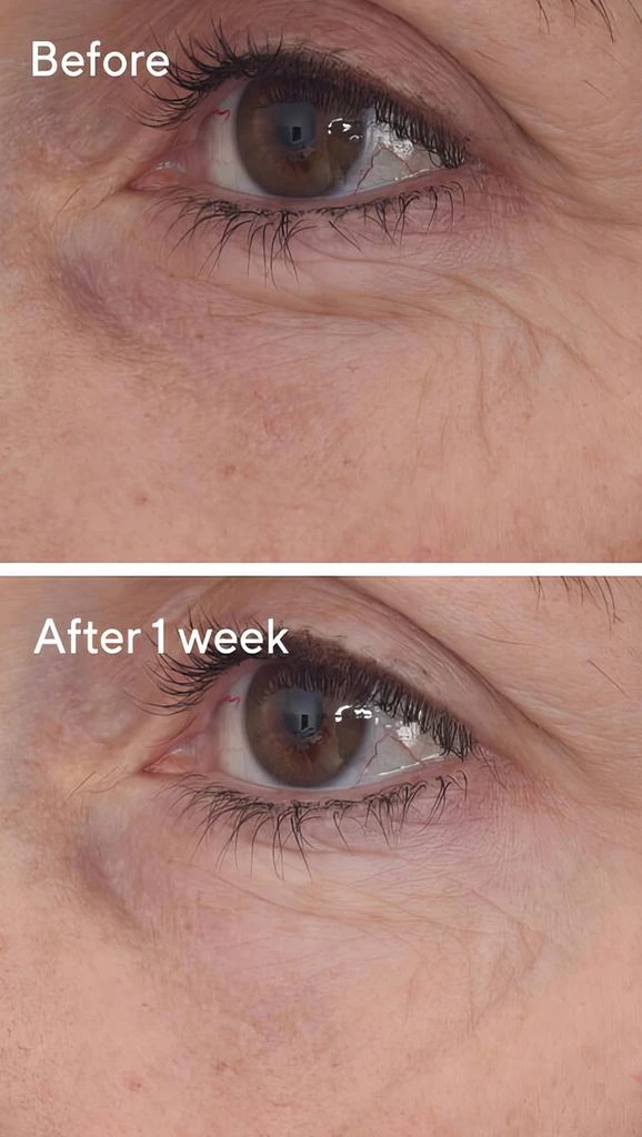 Murad Retinal ReSculpt Eye Lift Treatment 3