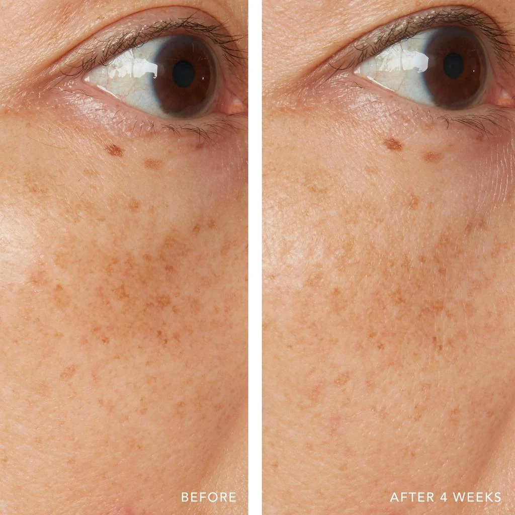 Lancer Skincare Lancer Skincare Advanced C Radiance Treatment with Vitamin C Collagen with Vitamin C Collagen Cofactor 10x 9