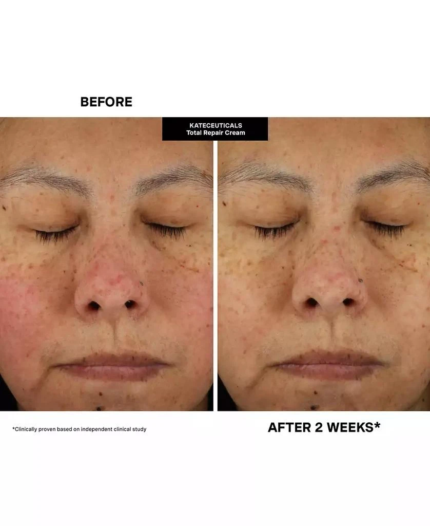 Kate Somerville KateCeuticals Total Repair Cream, 1 oz. 12