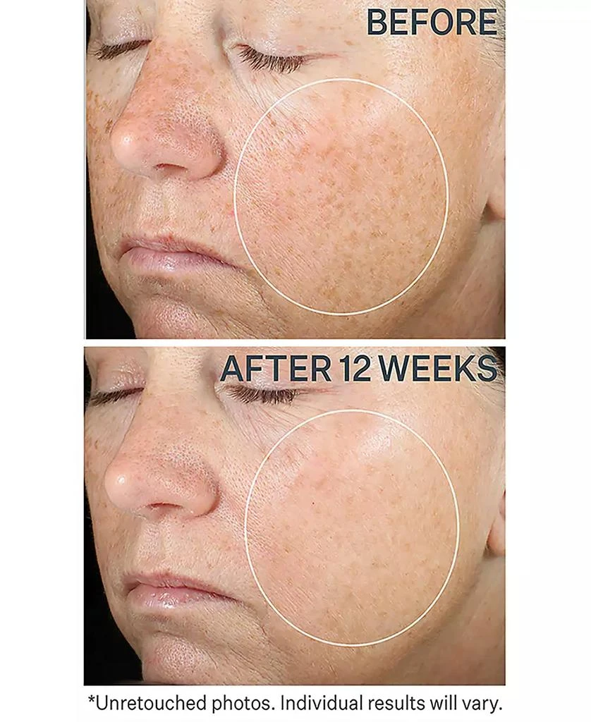 StriVectin Super C Retinol Brighten and Correct Vitamin C Serum, 1oz 5