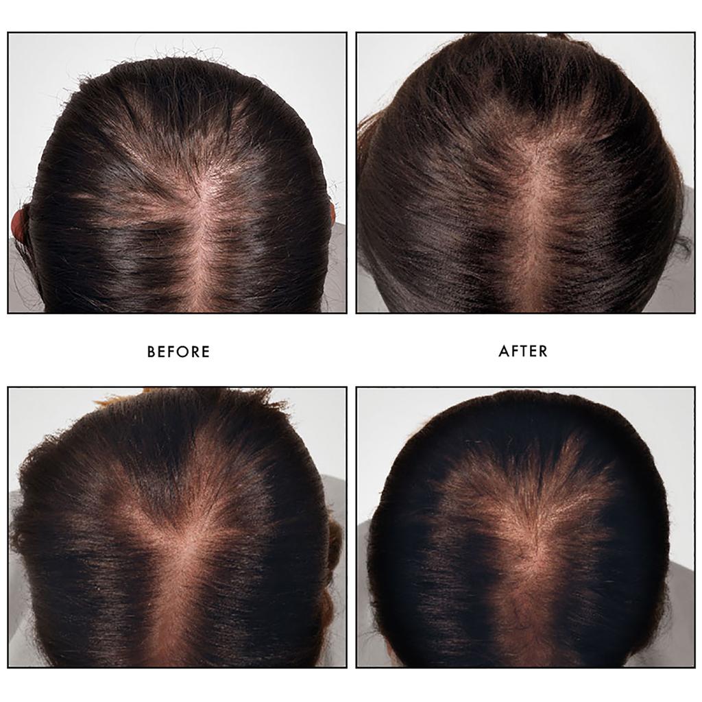 René Furterer René Furterer Triphasic Reactional Concentrated Serum