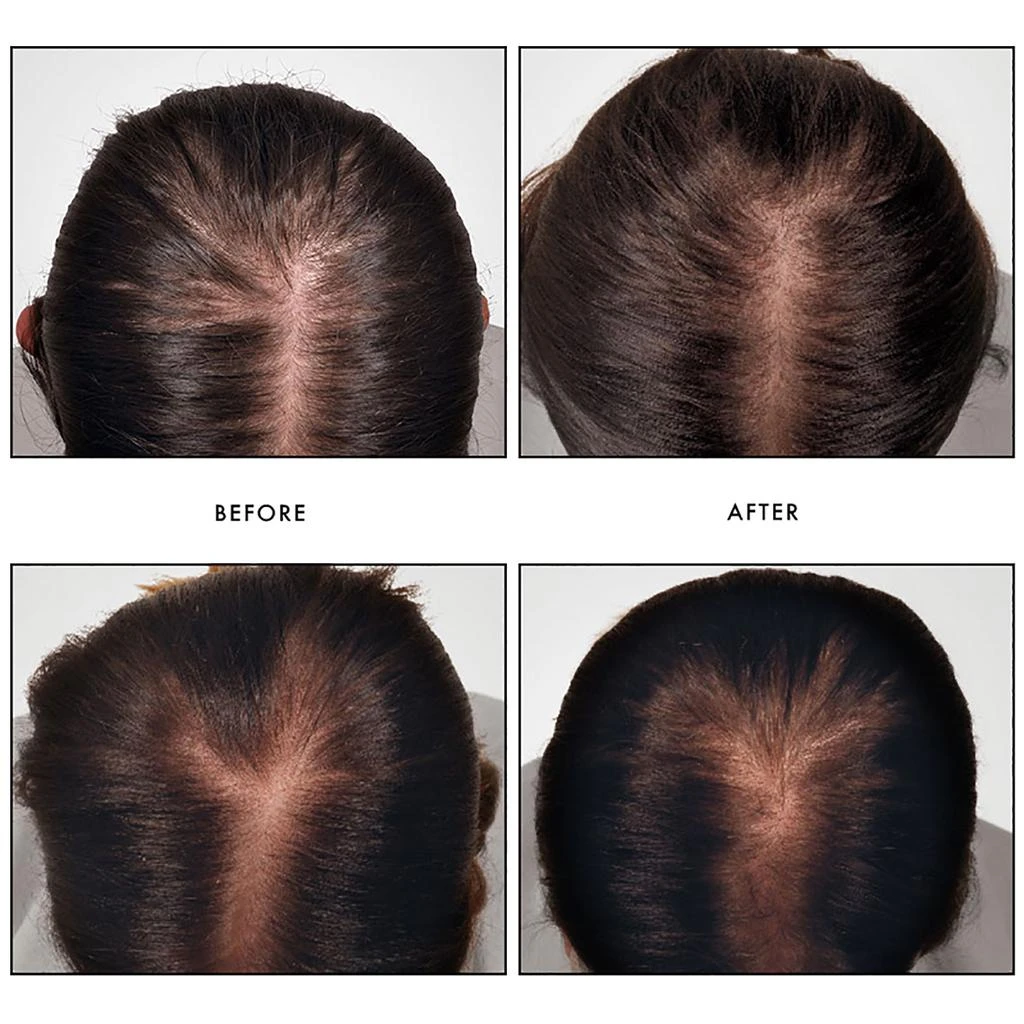 René Furterer René Furterer Triphasic Reactional Concentrated Serum 2
