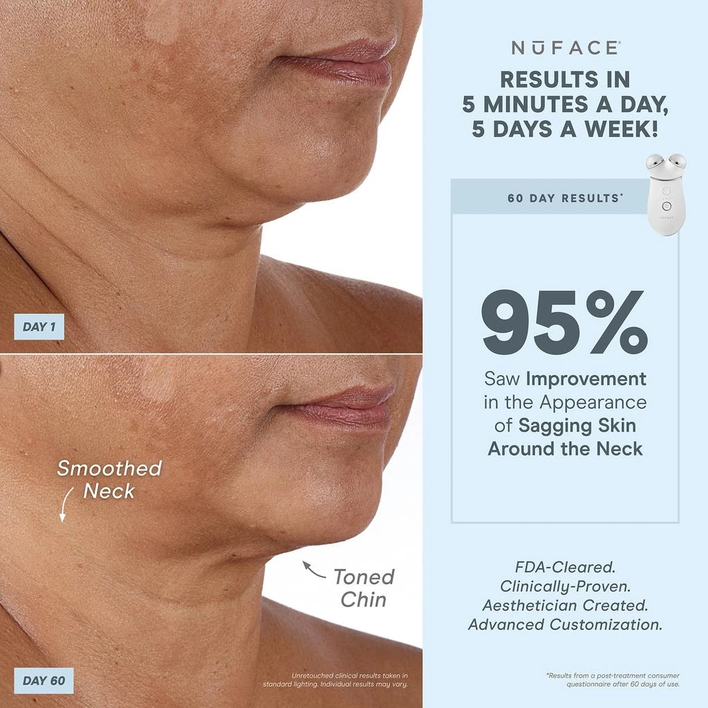 NuFace NuFACE Trinity+ Red Light and Wrinkle Reducer Attachment Set 4