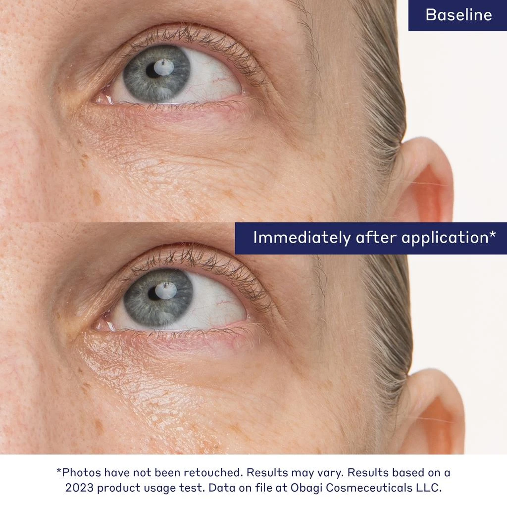 Obagi Medical Obagi Medical Rejuvenating Eye Gel Cream 7