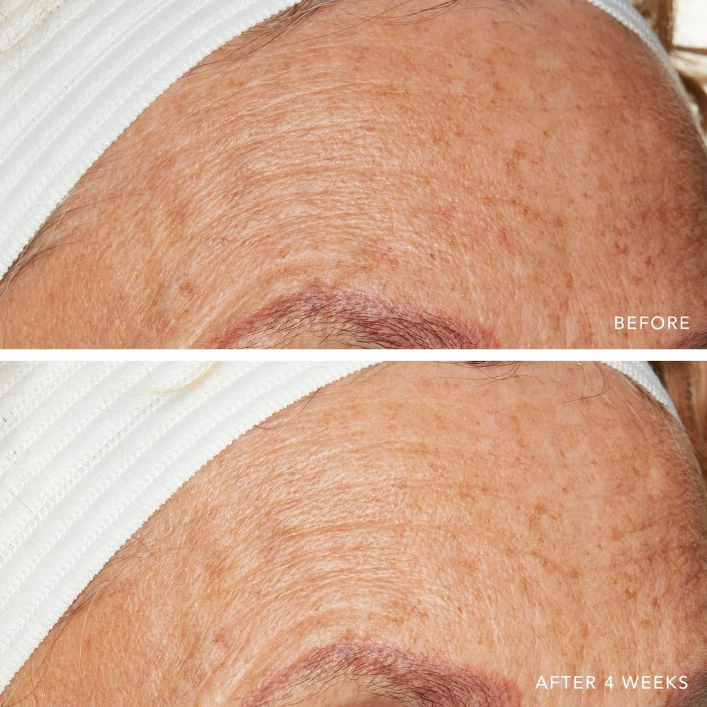 Lancer Skincare Lancer Skincare Advanced C Radiance Treatment with Vitamin C Collagen with Vitamin C Collagen Cofactor 10x 8