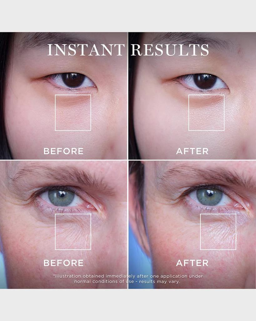 Lancôme Advanced Génifique Yeux 5