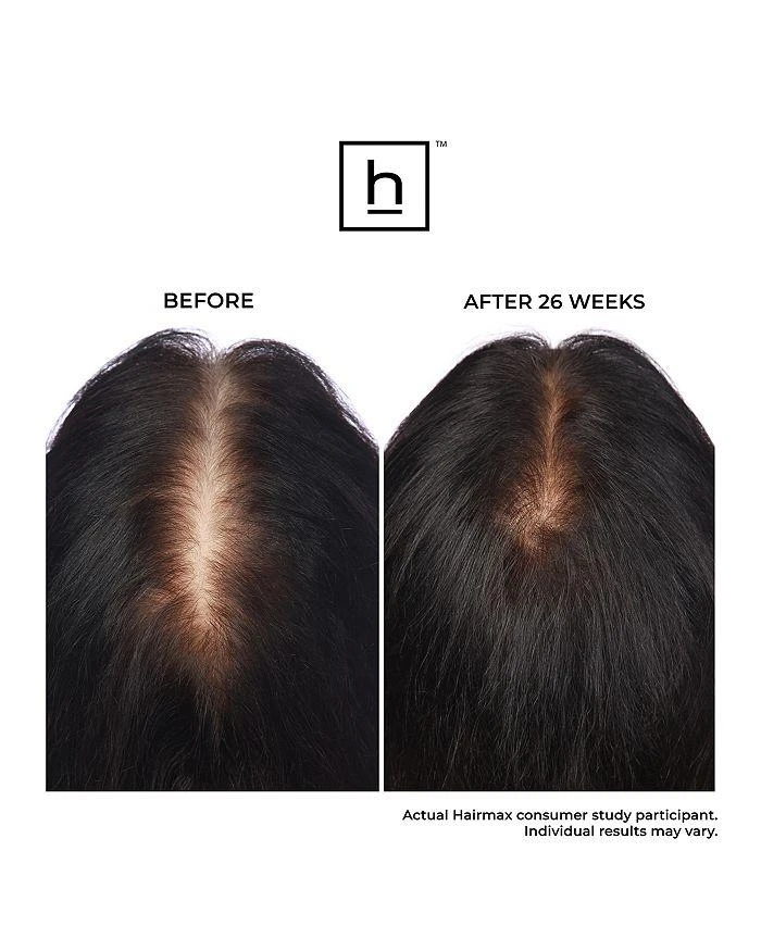 HairMax Ultima 12 Hair Growth LaserComb 8