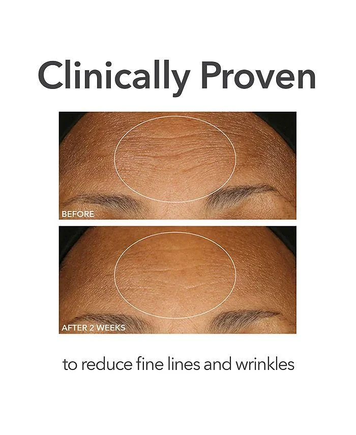 Dr. Dennis Gross Alpha Beta® Extra Strength Daily Peel 9