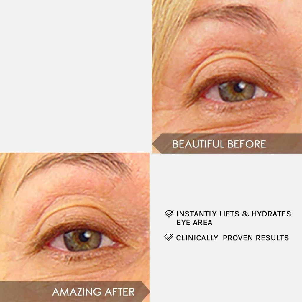 Mirenesse Winner Best Eye Serum - NEW Superstar Eye Serum 2