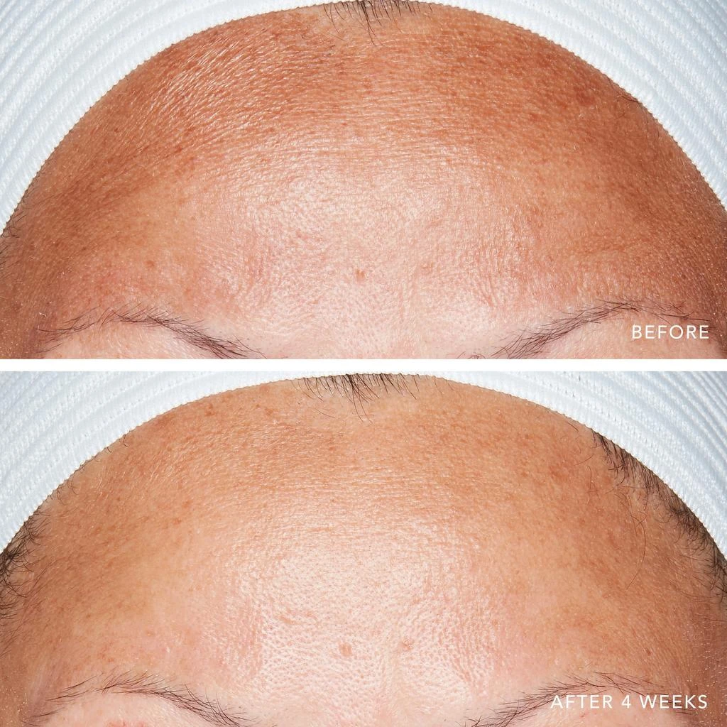 Lancer Skincare Lancer Skincare Advanced Retinol Treatment with 1.25 Retinol 4