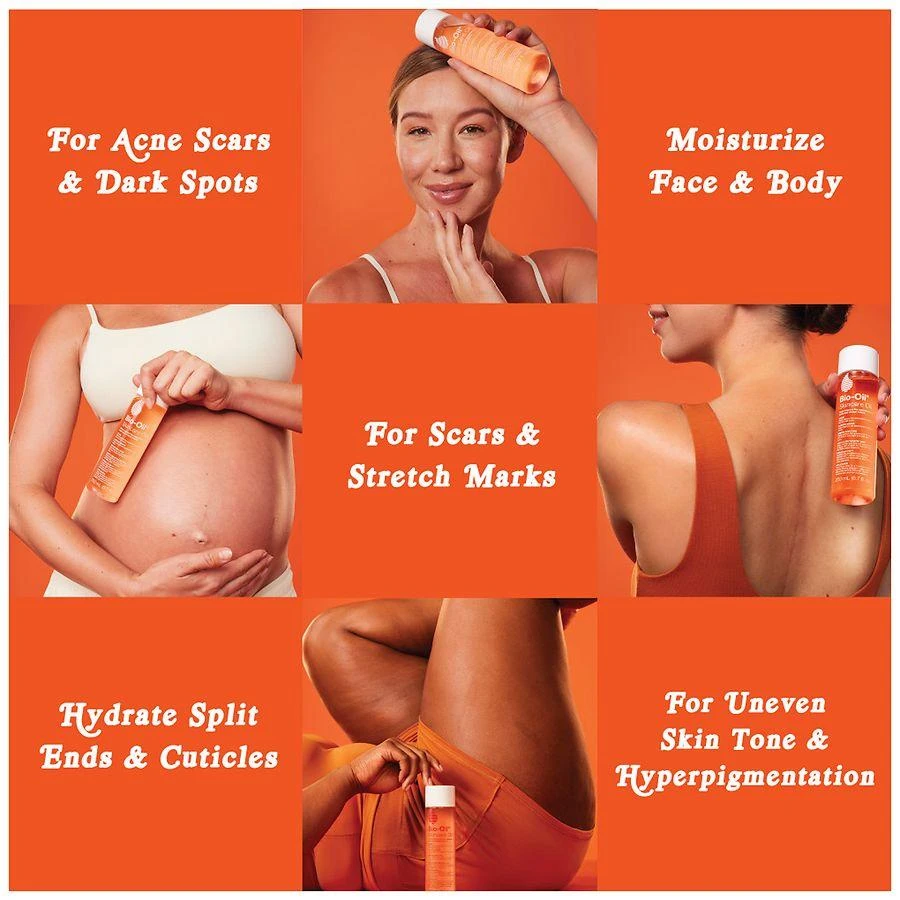 Bio-Oil Body Oil For Scars And Stretch Marks Serum Hydrates Dermatologist Recommended 9