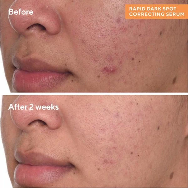 Murad Murad Rapid Dark Spot Correcting Serum 1 oz 2