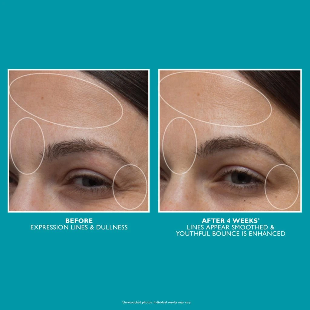 Peter Thomas Roth Peptide Skinjection Moisture Infusion Cream | 50ml 6