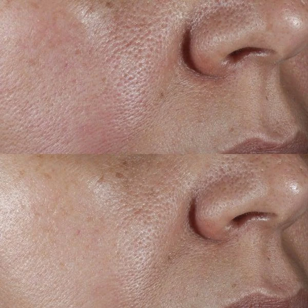 Perricone MD Perricone MD No:Rinse Intensive Pore Minimizing Toner 4oz FG 3