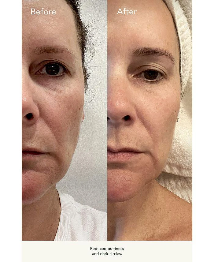 Kat Burki Rosehip Intense Recovery Eye Serum 0.5 oz. 4