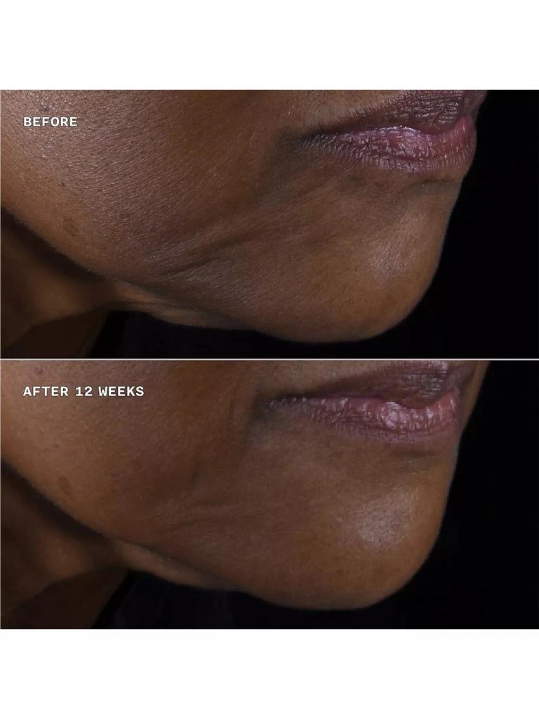 Clinique Smart Clinical Repair Lifting Face + Neck Cream 3