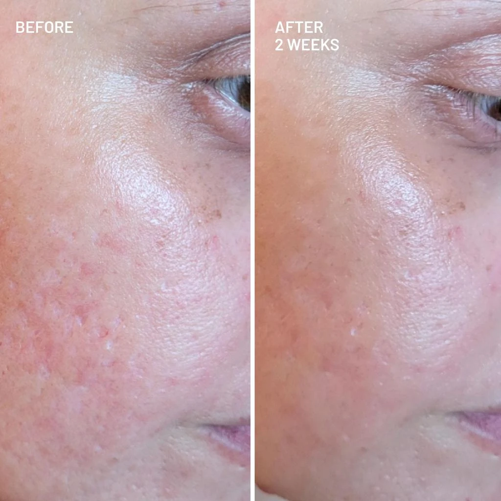 Dr. Brandt Skincare Gentle Radiance Cleansing Duo 2