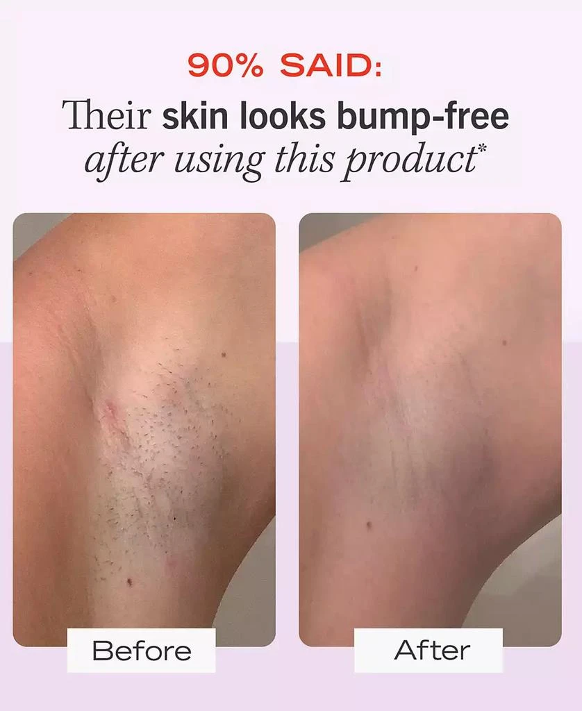 First Aid Beauty Ingrown Hair Pads With BHA & AHA, 60 pads 5