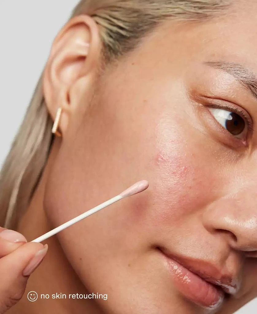 Kate Somerville EradiKate Acne Treatment, 1 oz. 5