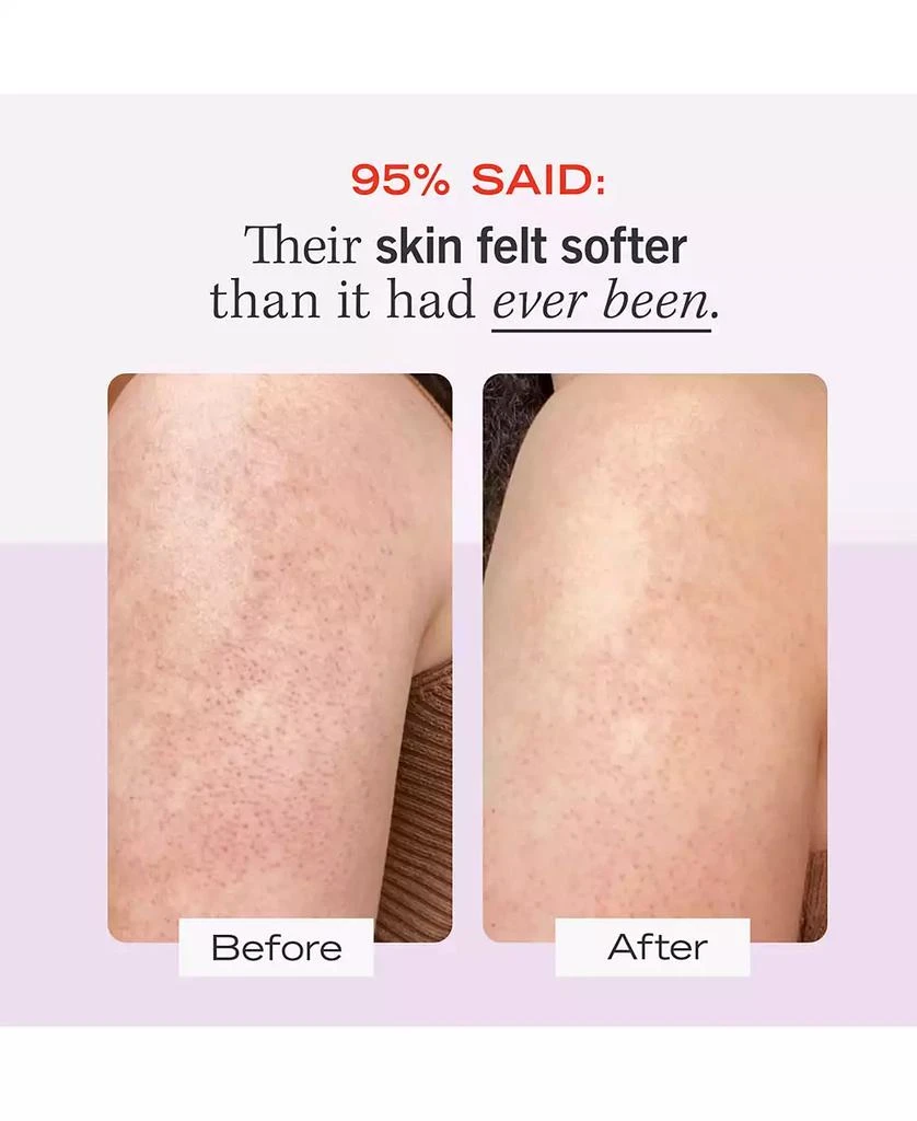 First Aid Beauty KP Bump Eraser Body Scrub with 10% AHA – Body Exfoliant for Keratosis Pilaris, 8.0 oz. 3