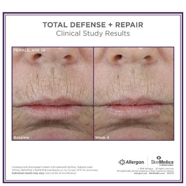 SkinMedica SkinMedica Total Defense and Repair SPF 34 - Tinted (2.3oz) 3