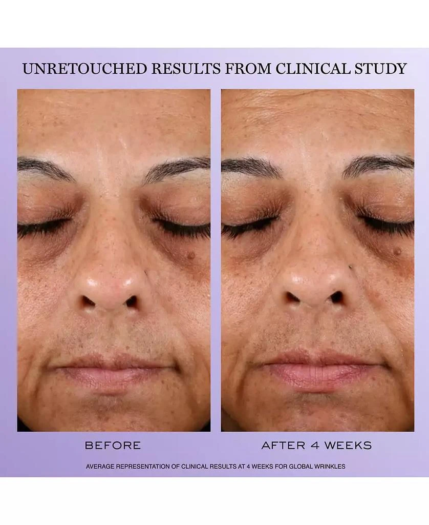 Lancôme 4-Pc. Rénergie Starter Kit Set 3