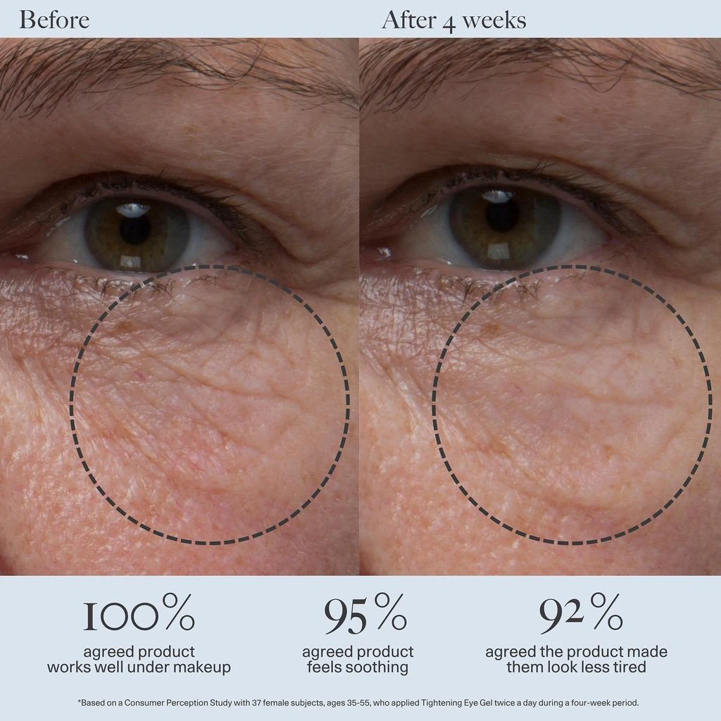 Dr. Loretta Dr. Loretta Tightening Eye Gel 4