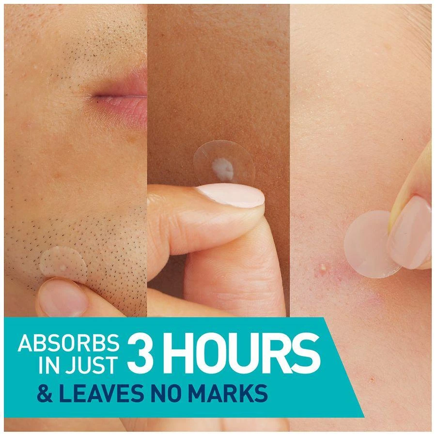 CeraVe Blemish Barrier Patches Oil-Absorbing Hydrocolloid Pimple Patches 2