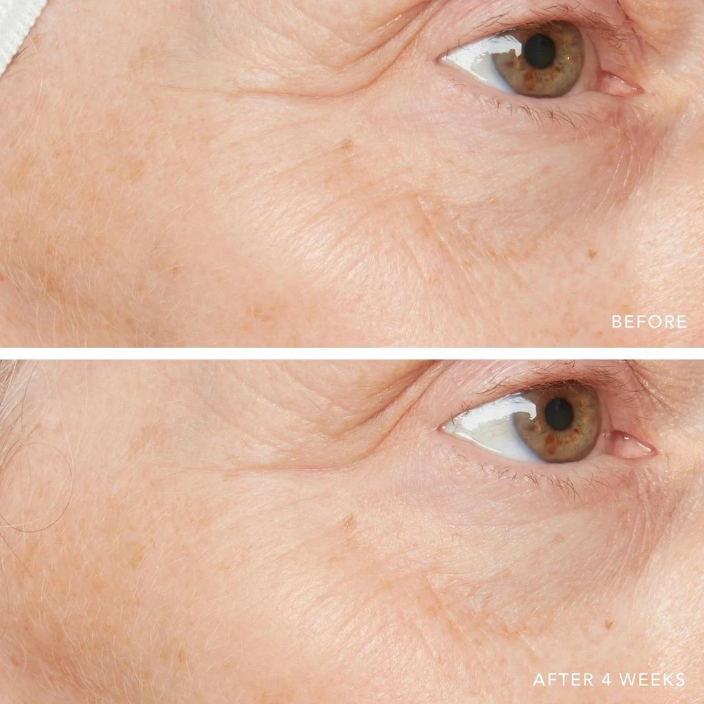 Lancer Skincare Lancer Skincare Active Rejuvenation Serum with Triple Dermal Complex 7