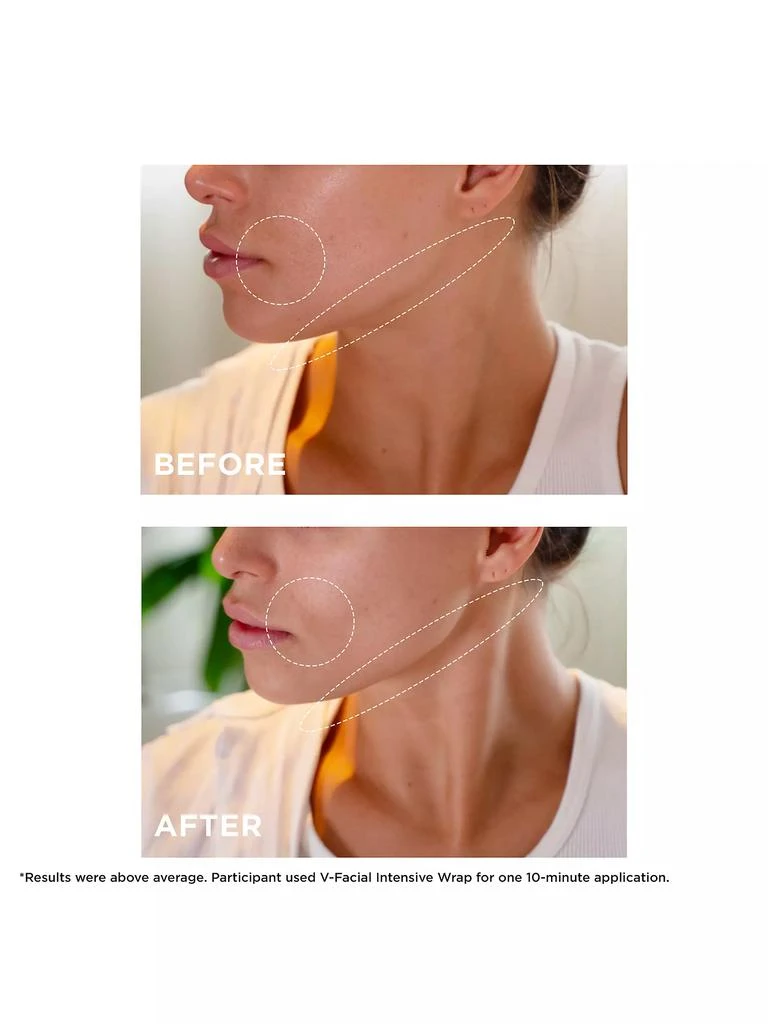 Clarins V-Facial Instant Depuffing Face Mask 3