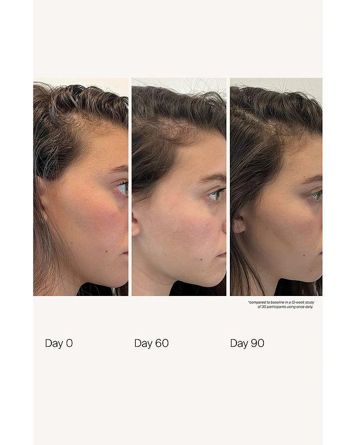 Living Proof Scalp Care Density Serum 1.7 oz. 9