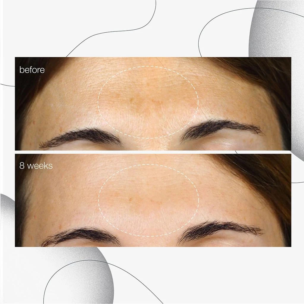 Dermalogica PowerBright Dark Spot Serum 2