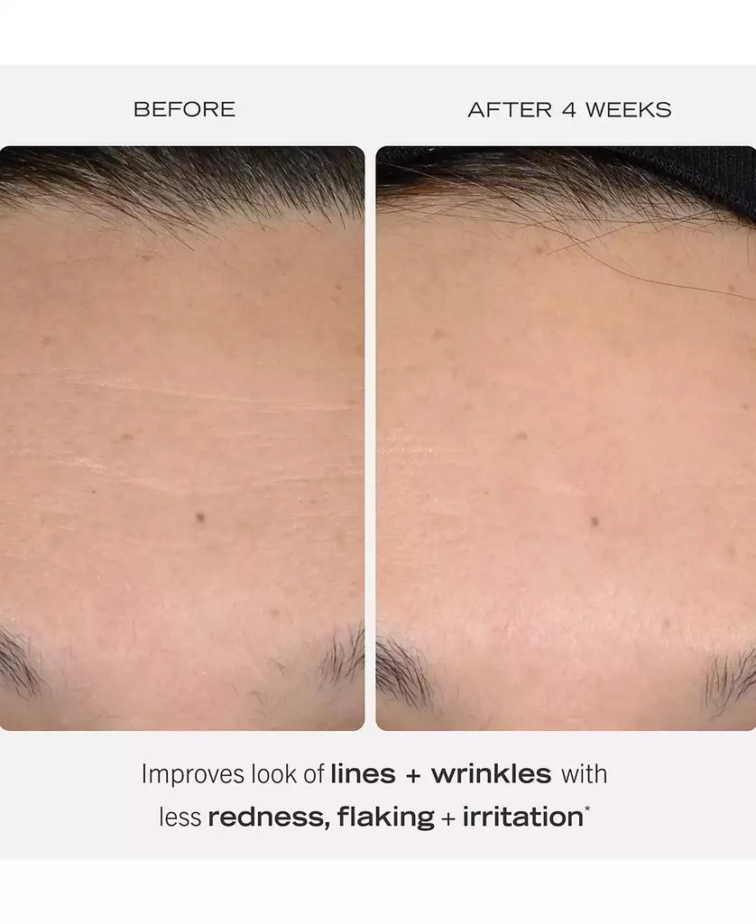 First Aid Beauty 0.3% Retinol Complex Serum With Peptides, 1 oz. 2