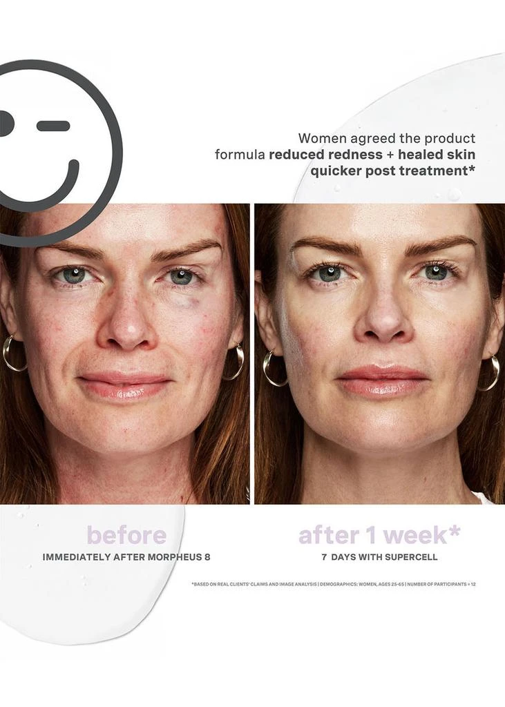 Kate Somerville SuperCell Rejuvenation Serum 30ml 6