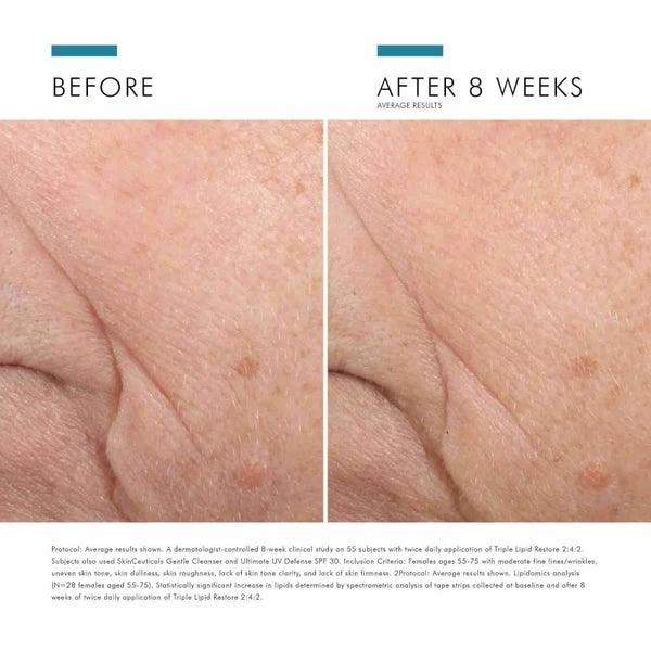 SkinCeuticals SkinCeuticals Triple Lipid Restore 2:4:2 5