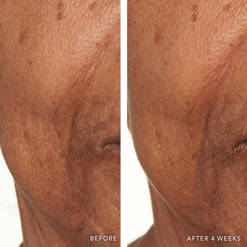 Lancer Skincare Lancer Skincare Active Rejuvenation Serum with Triple Dermal Complex 3