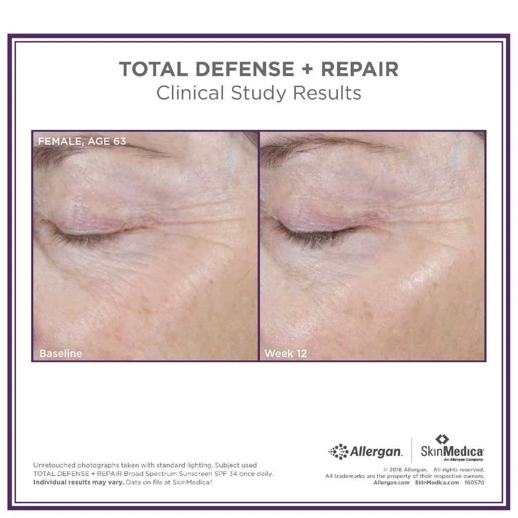 SkinMedica SkinMedica Total Defense Repair SPF 34 - Tinted 4