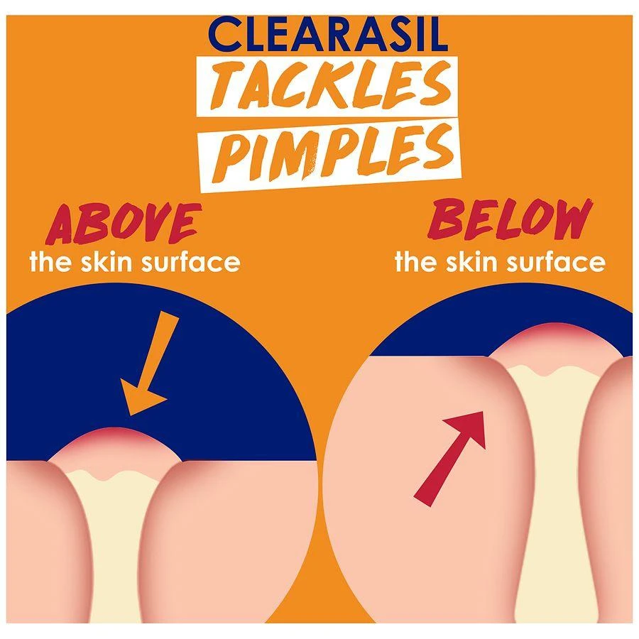 Clearasil Stubborn Acne Control 5-in-1 Spot Treatment Cream 5