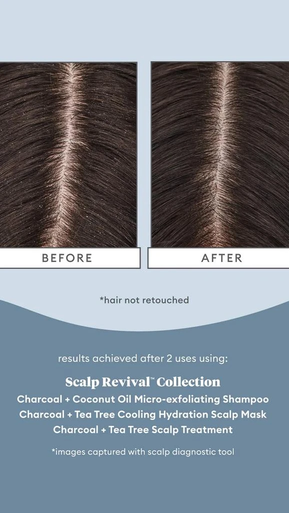 Briogeo Scalp Revival Charcoal + Tea Tree Scalp Treatment 8