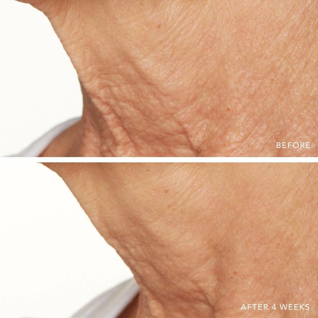 Lancer Skincare Lancer Skincare Active Rejuvenation Serum with Triple Dermal Complex 5