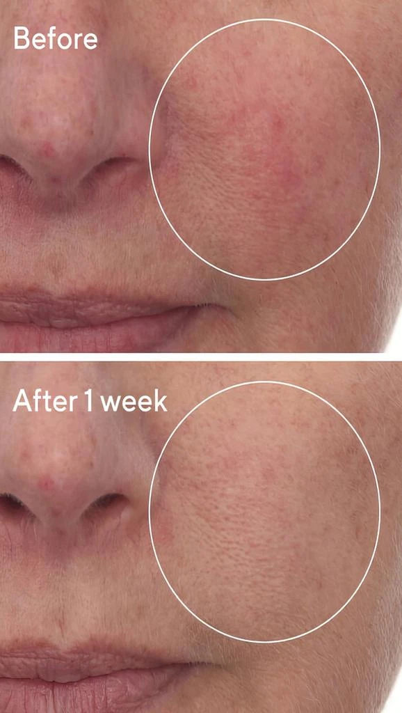 Murad Cellular Hydration Barrier Repair Serum 3