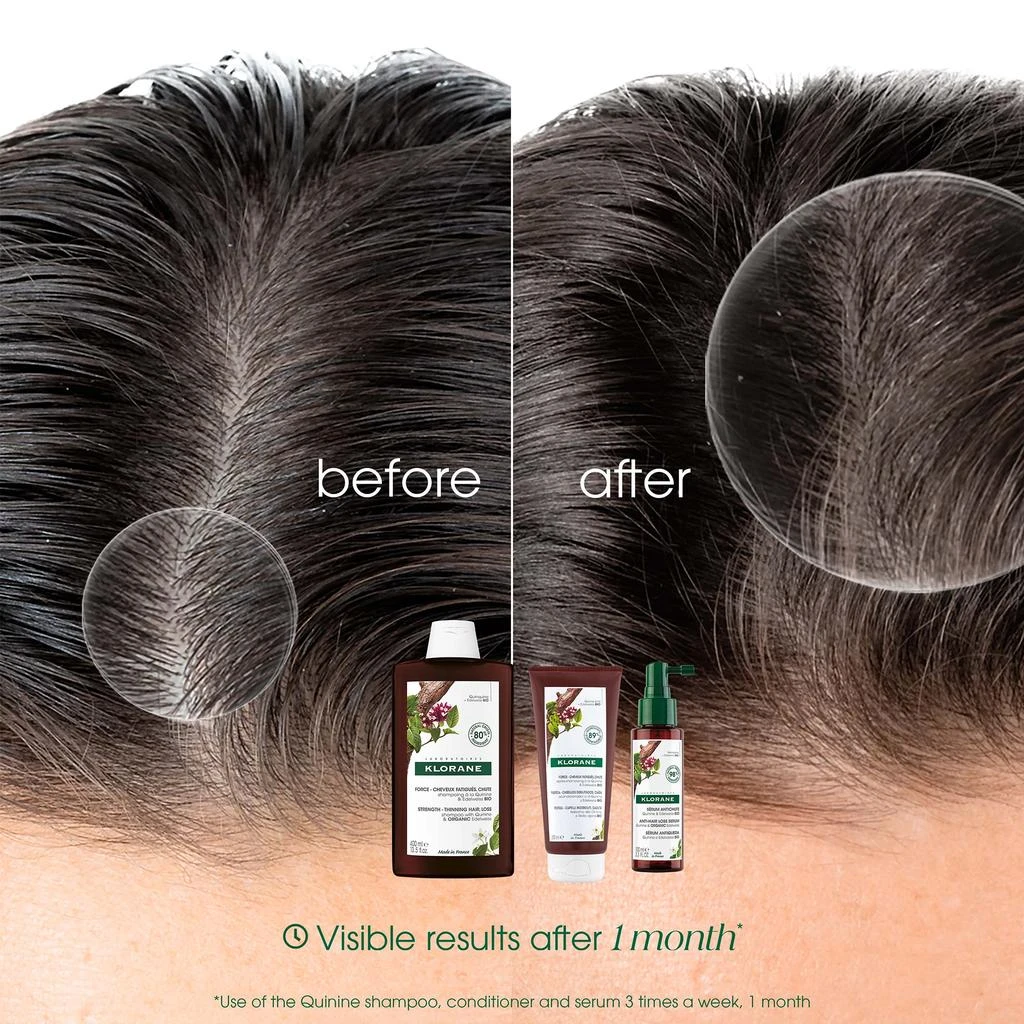 KLORANE KLORANE Strengthening Shampoo for Thinning, Tired Hair with Quinine and ORGANIC Edelweiss 400ml 4