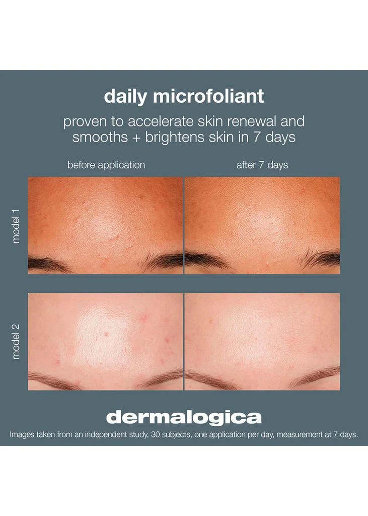 Dermalogica Daily Microfoliant Refill 74g 4