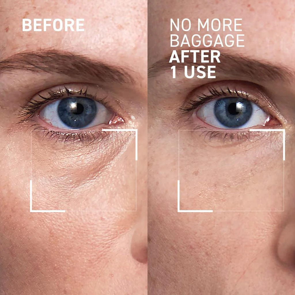 Dr. Brandt Skincare Quick Fix Kit - One Kit - 4 Instant Results - 4 Bestsellers 3