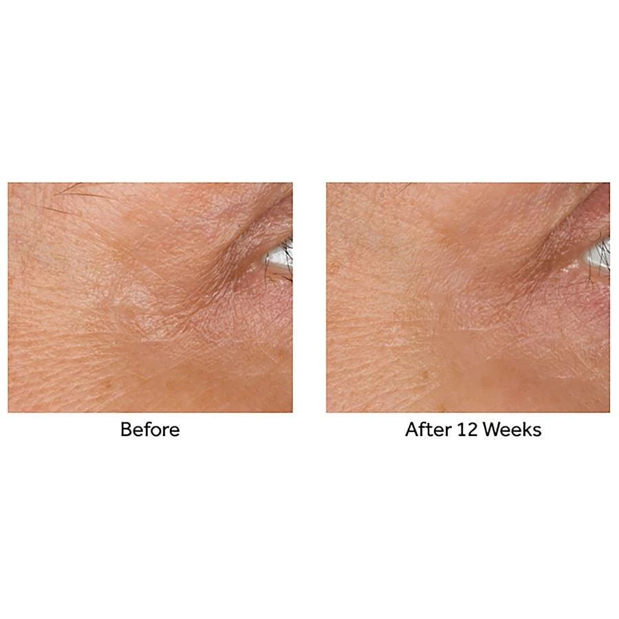 No7 Laboratories Line Correcting Booster Serum 9